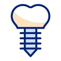 Dental implant treatment at AB’S Dental & Aesthetics Guntur