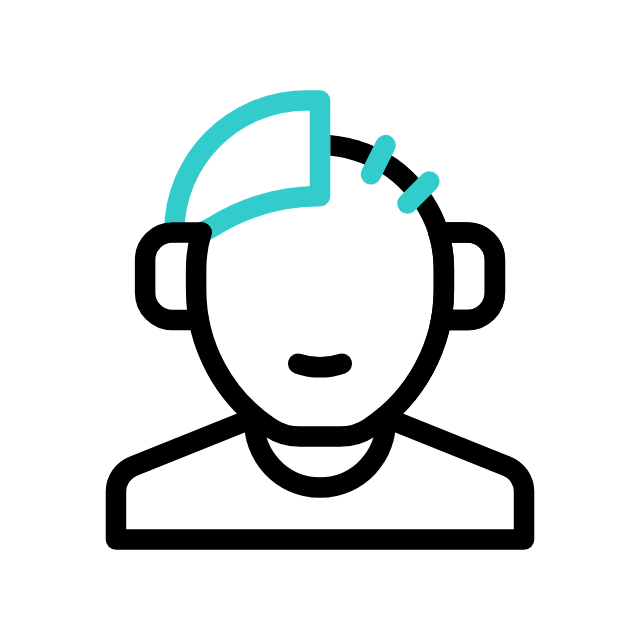 Hair transplant procedure for hair loss treatment in Guntur